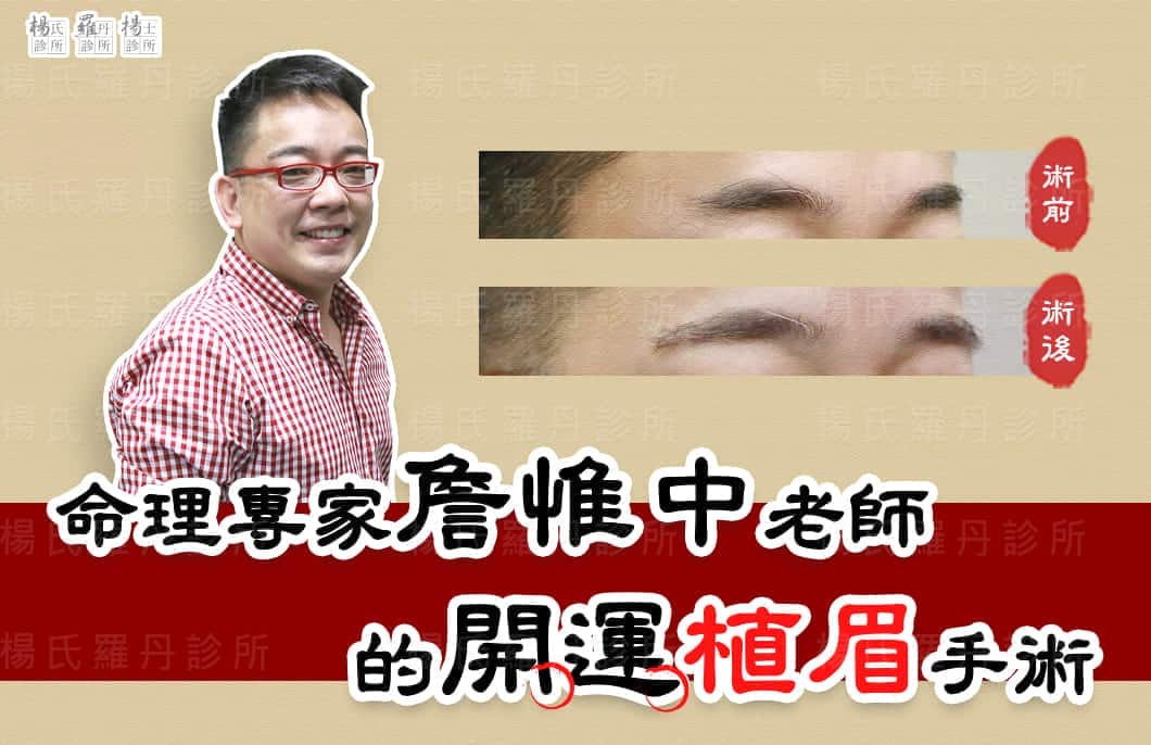【植髮】命理專家詹惟中老師的開運植眉手術！